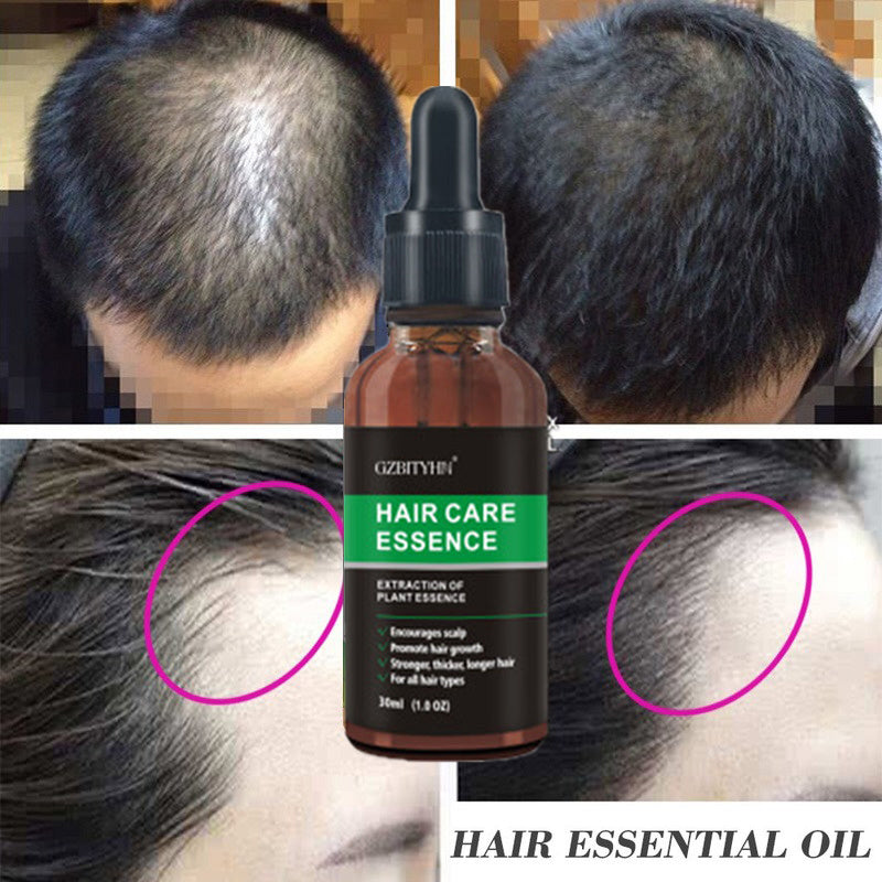 Aceité Esencial para el Crecimiento del Cabello - Regenera, Nutre y Fortalece