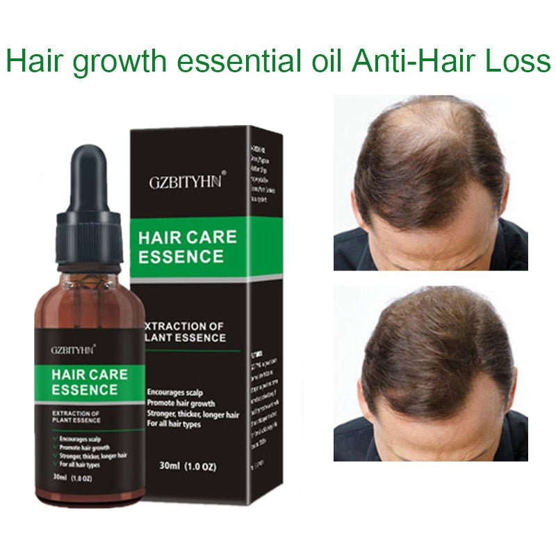 Aceité Esencial para el Crecimiento del Cabello - Regenera, Nutre y Fortalece