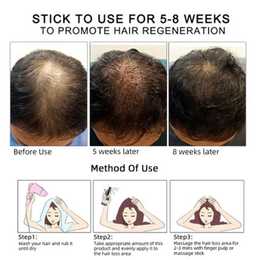 Aceité Esencial para el Crecimiento del Cabello - Regenera, Nutre y Fortalece