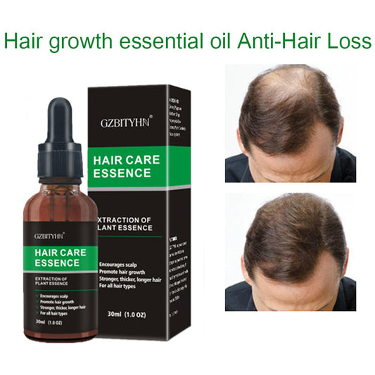 Aceité Esencial para el Crecimiento del Cabello - Regenera, Nutre y Fortalece